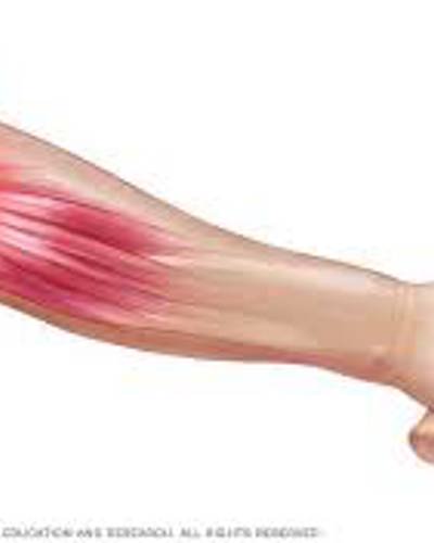 Golfers Elbow and Tennis Elbow