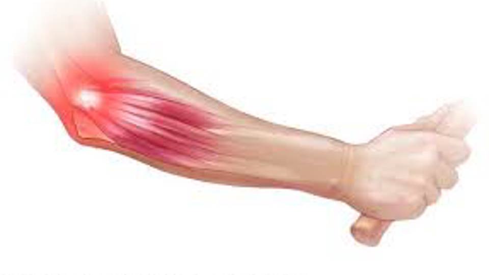 Golfers Elbow and Tennis Elbow