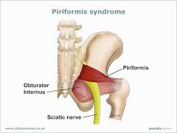 Hip Pain Physio In Rugby