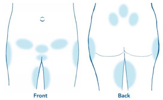 Pelvic girdle pain (PGP) in pregnancy - South Tees Hospitals NHS